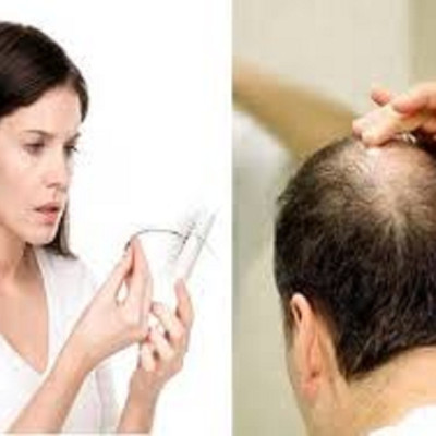 TINH DẦU BƯỞI NGUYÊN CHẤT MẸ KEN-Chai 100ml