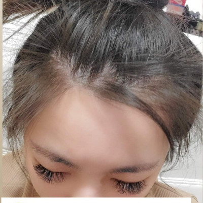 Serum Huyết Thanh Mọc Tóc Weilaiya Hỗ Trợ Giảm Rụng, Kích Mọc Tóc Nhanh - Set 8 Lọ x 5ml