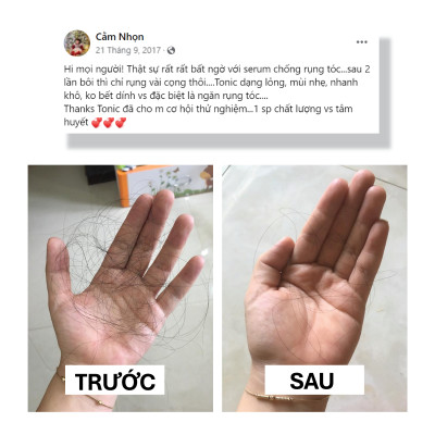 SERUM GIẢM GÃY RỤNG TÓC HAIR RECOVERY SERUM 50ml