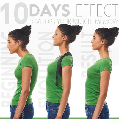 Áo chống gù lưng cho nam nữ, đai đeo khắc phục lưng tôm cải thiện vóc dáng mi01 - Chính hãng miDoctor