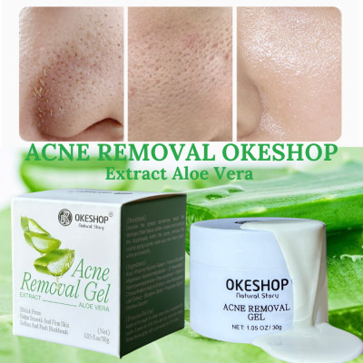 Gel Lột Mụn Nha Đam OKESHOP 30ml - Giải Pháp Loại Bỏ Mụn Đầu Đen - Mụn Cám - Bạ Nhờn - Làm Sạch Sâu Và Thu Nhỏ Lỗ Chân Lông