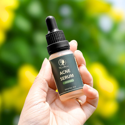 Acne serum, serum mụn thảo mộc đánh bay mọi loại mụn cứng đầu Wonmom 20ml