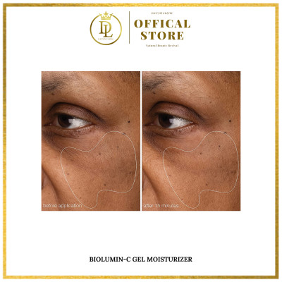 Tinh chất giảm thâm,  ngăn ngừa mụn và sáng đều màu da Dermalogica BIOLUMIN-C GEL MOISTURIZER 50ml