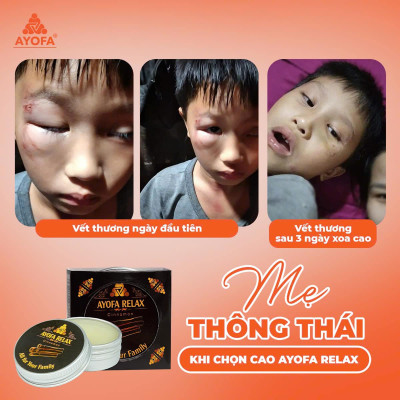 Cao Xoa Bóp Massage Thảo Dược Giúp Phục Hồi Và Làm Dịu Nhanh Chóng Ayofa Relax Hương Quế 60G
