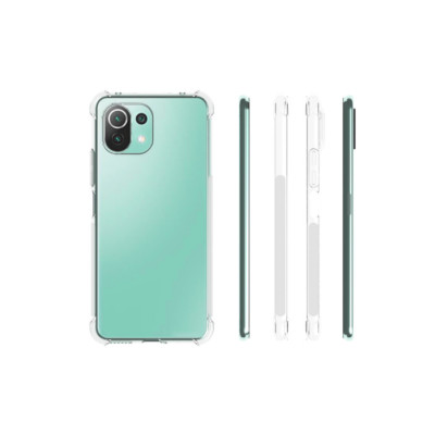 Ốp lưng dẻo trong chống sốc Xiaomi Mi 11 Lite - Hàng nhập khẩu